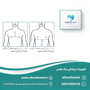 Alternative view of کتف قوزبند آتل‌دار نئوپرنی Cured